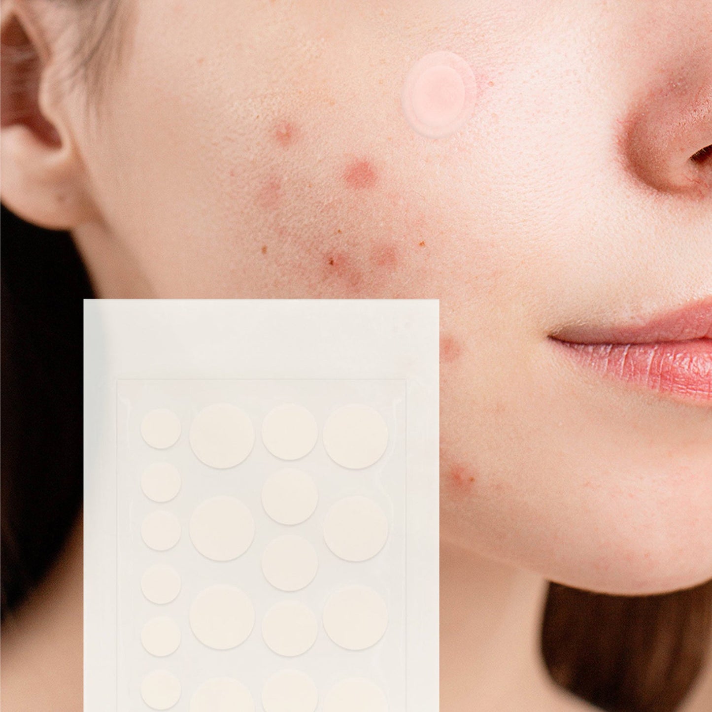 Clear Petal Patches — Hydrocolloid Acne Patches 5 pack